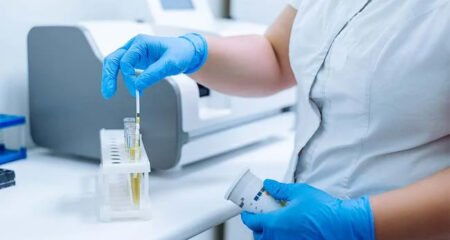 How Long Does Labcorp Take for Urine Results