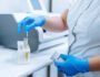 How Long Does Labcorp Take for Urine Results