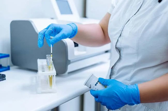 How Long Does Labcorp Take for Urine Results