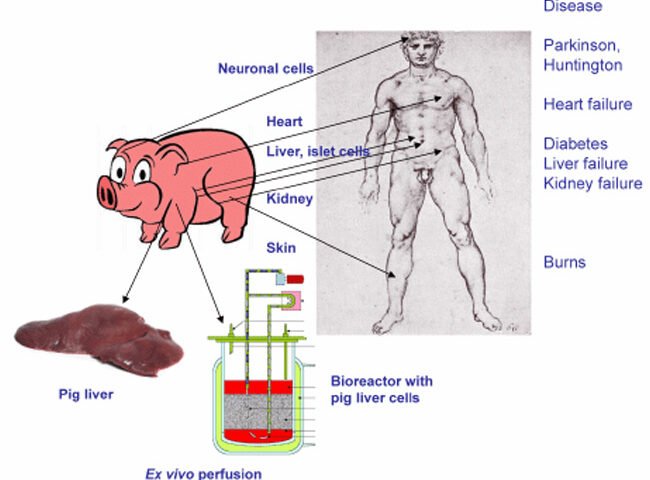 Xenotransplantation
